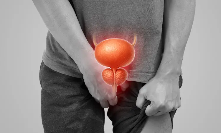 Advanced Prostate Cancer Care Guide: Modern Treatments, Immunotherapy, Radiation Therapy, and Clinical Research
